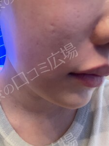 治療前の症例写真
