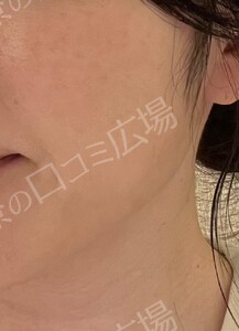 治療前の症例写真