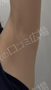 治療前の症例写真