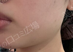 治療前の症例写真