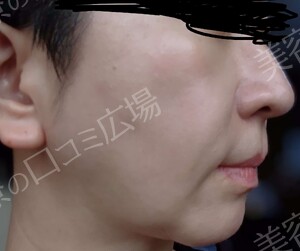 治療結果の症例写真