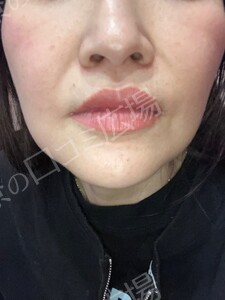 治療結果の症例写真