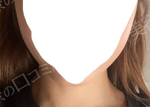 治療結果の症例写真