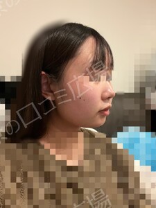 治療直後の症例写真
