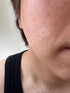 治療結果の症例写真
