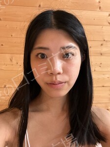 治療結果の症例写真