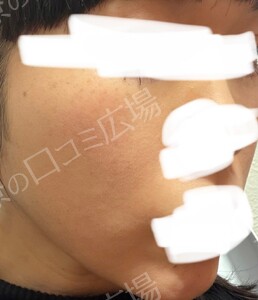 治療結果の症例写真