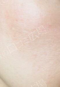 治療結果の症例写真