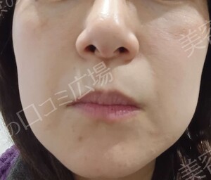 治療前の症例写真