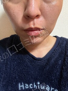 治療前の症例写真