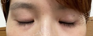 治療前の症例写真