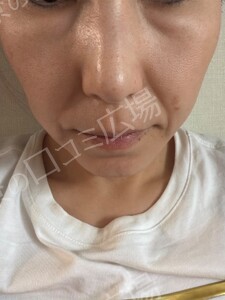 治療結果の症例写真