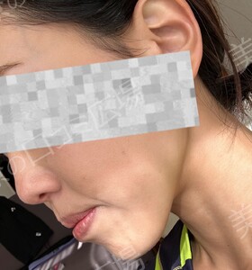 治療結果の症例写真