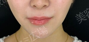 治療結果の症例写真