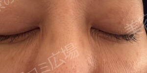治療結果の症例写真