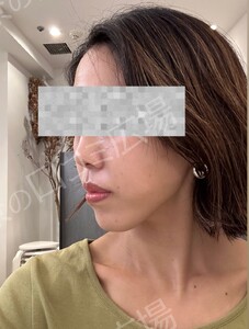 治療前の症例写真