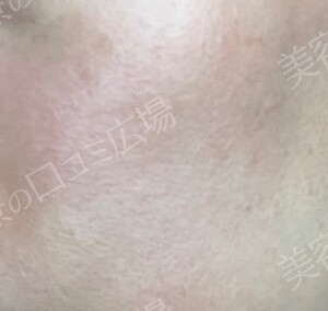 治療前の症例写真