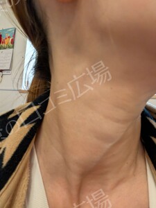 治療結果の症例写真