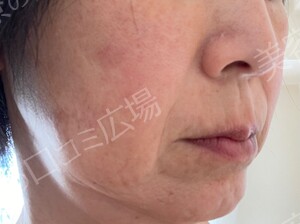 治療前の症例写真