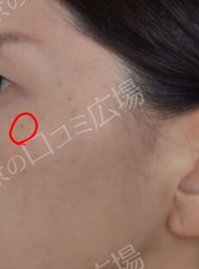 治療結果の症例写真
