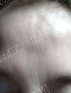 治療前の症例写真