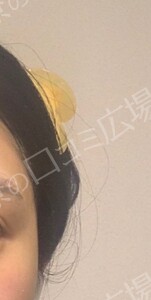 治療前の症例写真