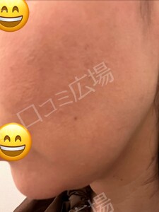 治療結果の症例写真