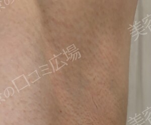 治療結果の症例写真