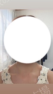 治療前の症例写真