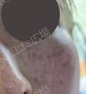 治療前の症例写真