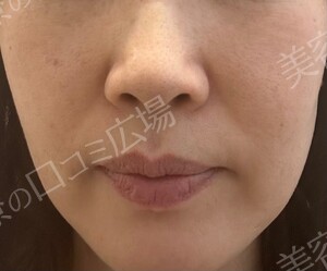 治療前の症例写真