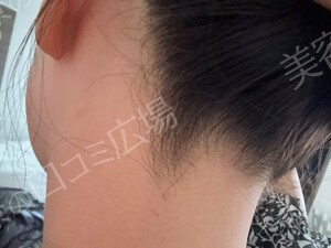 治療前の症例写真