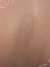 施術前の状態