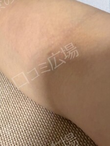 治療結果の症例写真