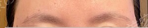 治療前の症例写真