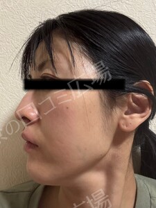 治療前の症例写真