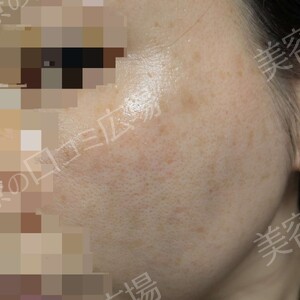 治療結果の症例写真
