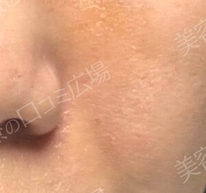 治療結果の症例写真