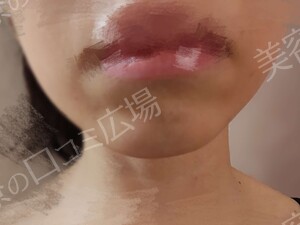 治療前の症例写真