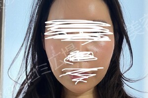 治療前の症例写真