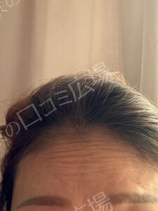 治療前の症例写真