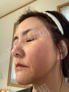 治療結果の症例写真