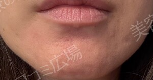 エバーグリーンメディカルクリニックの症例写真[アフター]