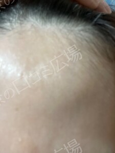 治療結果の症例写真