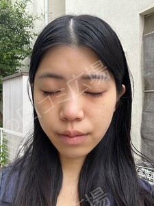 治療前の症例写真