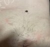 施術前の状態
