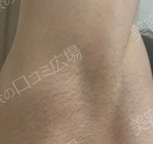 治療前の症例写真