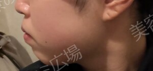 治療前の症例写真