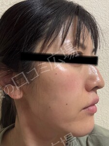 治療前の症例写真