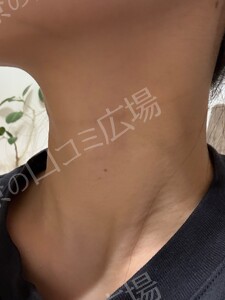 治療結果の症例写真
